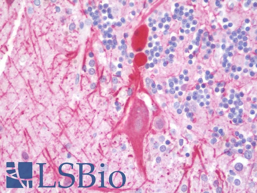 PathPlus™ NEFH / NF-H Antibody