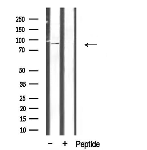 CHSY1 Antibody