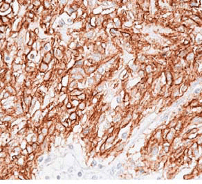 ANO1 / DOG1 / TMEM16A Antibody (aa904-986, clone DOG1.1)
