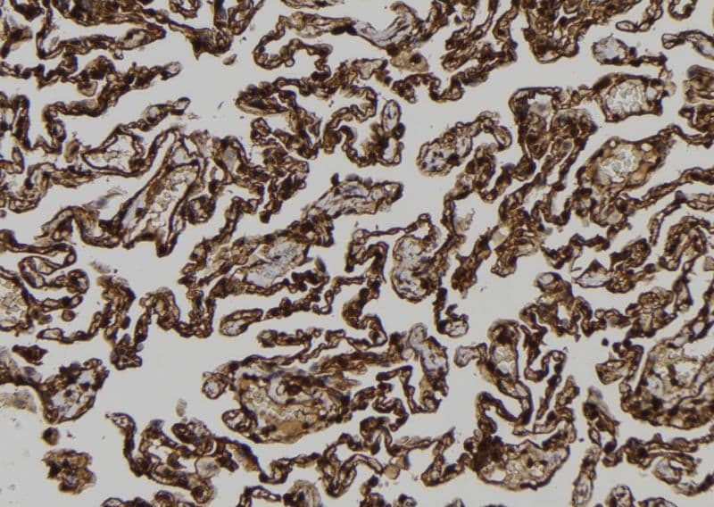 Polyclonal Rabbit anti-Human RACGAP1 / MGCRACGAP Antibody (IHC, IF, WB)