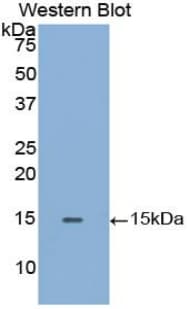 GLA / Alpha Galactosidase Antibody (aa1-80, Biotin)