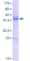 Human CABP7 Protein (Recombinant GST)