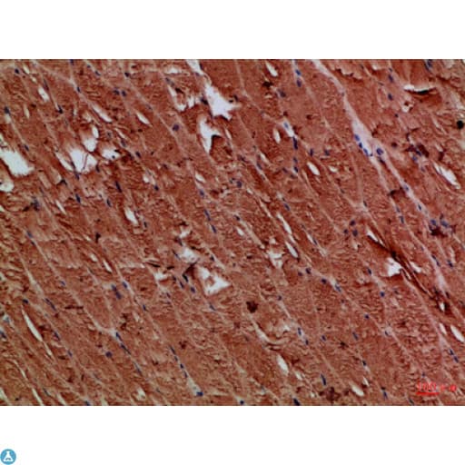 TNRC5 / CNPY3 Antibody