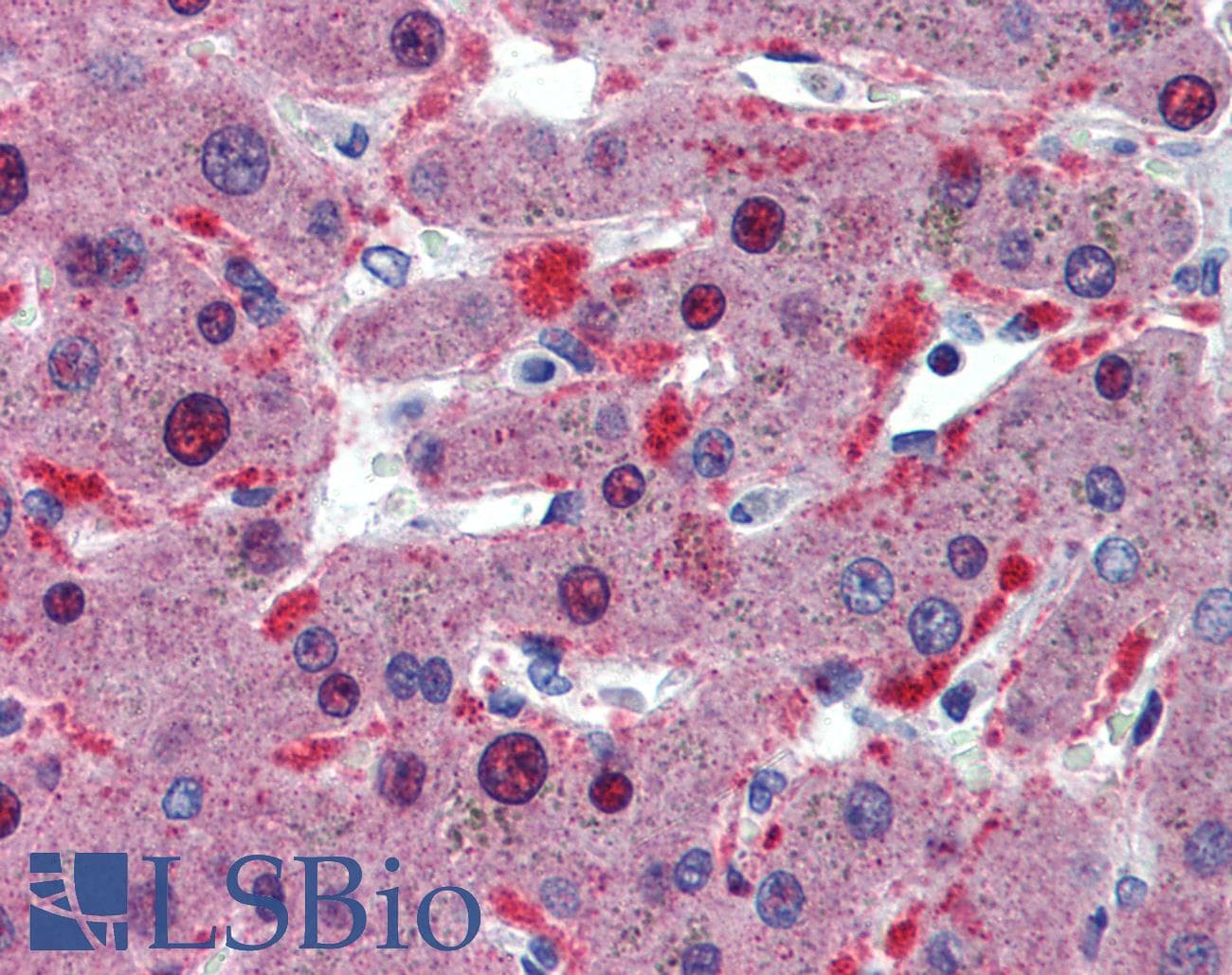 CELF1 / CUGBP1 Antibody (aa120-169)