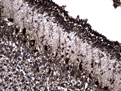 Monoclonal Mouse anti-Human UBE2D4 Antibody (clone OTI1B1, Carrier-free, IHC, WB)