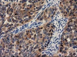 PYCRL Antibody (clone OTI1C11)