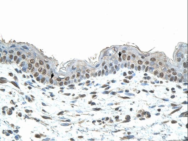 Polyclonal Rabbit anti-Human SMAD1 Antibody (N-Terminus, IHC, WB)
