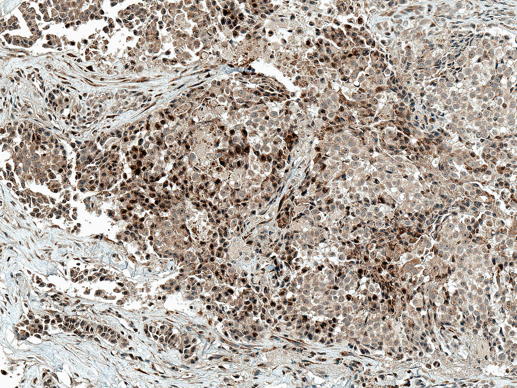 JUN / c-Jun Antibody