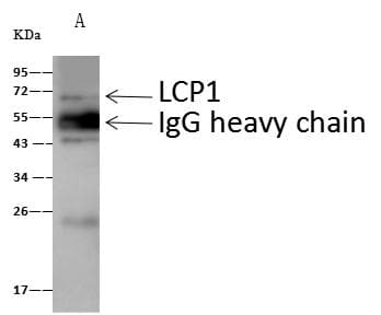 Polyclonal Rabbit anti-Human LCP1 / L-Plastin Antibody (Preservative Free, IF, WB)