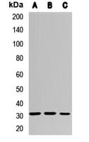 Polyclonal Rabbit anti-Human MMACHC Antibody (WB)
