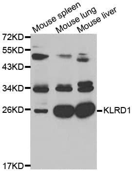 KLRD1 / CD94 Antibody