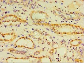 Polyclonal Rabbit anti-Human CRD / CRX Antibody (aa120-285, IHC, WB)
