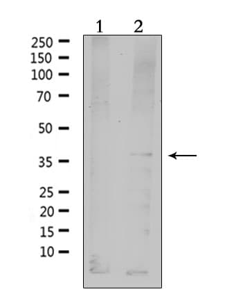 MC4R / Melanocortin 4 Receptor Antibody