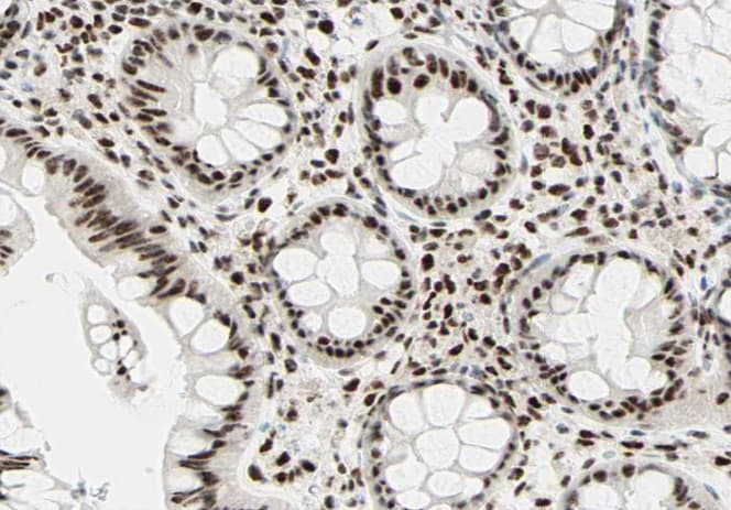 MCM2 Antibody
