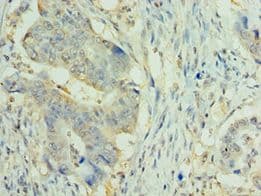 NLRP2 / NALP2 Antibody (aa1-220)