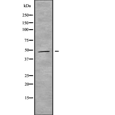 MAGEA11 Antibody