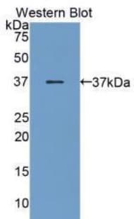 PGC / Pepsin C Antibody (aa61-388)