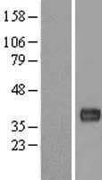 LBHD1 / C11orf48 Protein (Over-Expression Lysate Myc-DDK (Flag))