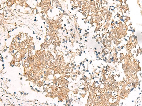 HNF1A / HNF1 Antibody