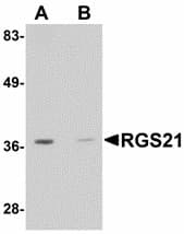 IHC-plus™ RGS21 Antibody