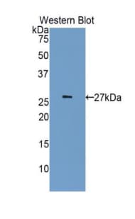 CDK5 Antibody (aa92-273)