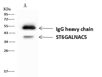 Polyclonal Rabbit anti-Human ST6GALNAC5 Antibody (WB)