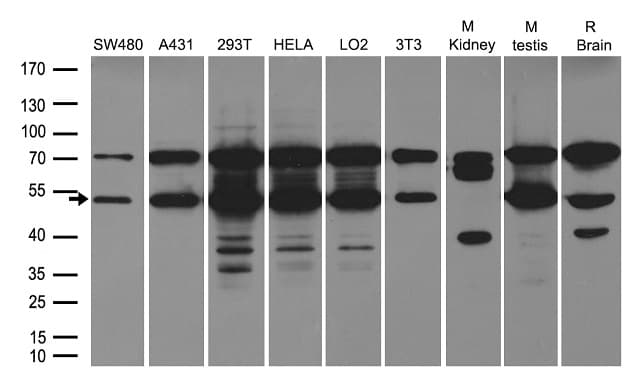 ST13 Antibody