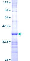 Human SCN8A / Nav1.6 Protein (Recombinant GST, N-terminus)