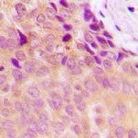 NDUFS5 Antibody (Internal)