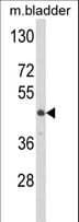 Polyclonal Rabbit anti-Human Lumican Antibody (aa64-91, IHC, WB)