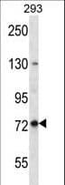 Paraplegin / SPG7 Antibody (aa115-141)