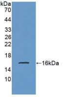 SST / Somatostatin Antibody (aa27-116, APC)