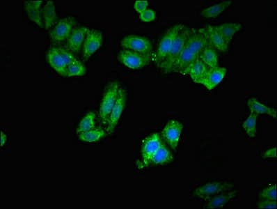ARTS1 / ERAP1 Antibody