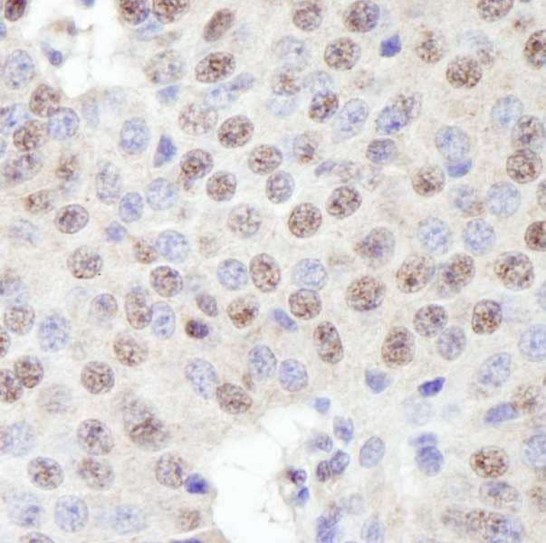 ZNF106 / ZFP106 Antibody (aa1833-1883)