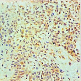 Monoclonal Mouse anti-Human ANXA2 / Annexin A2 Antibody (clone 1A1E1, IHC, WB)