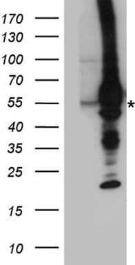 GRK5 Antibody