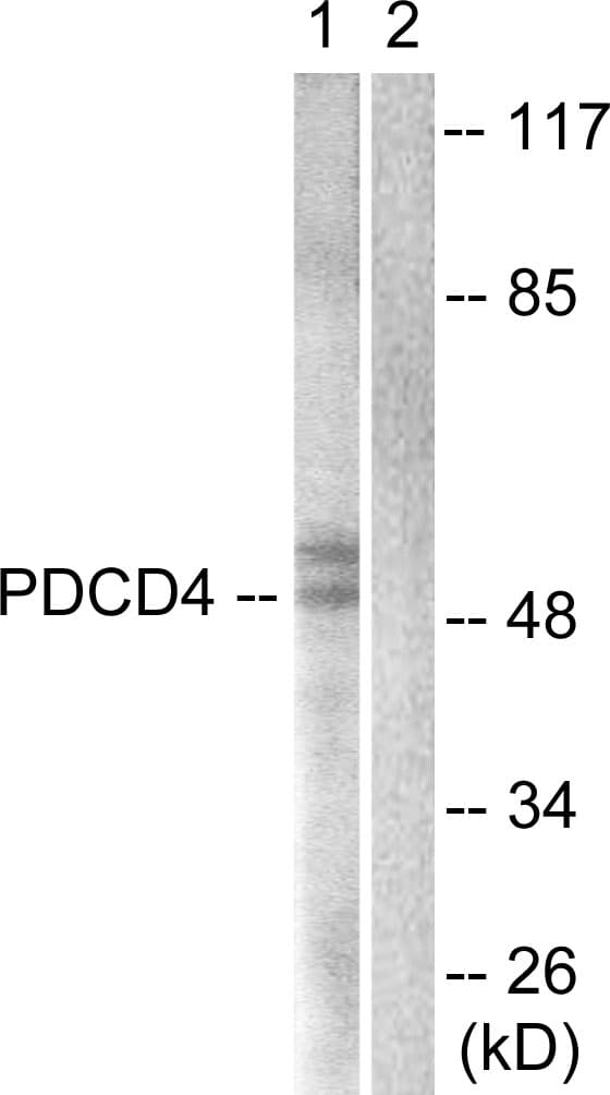 PDCD4 Antibody (aa420-469)