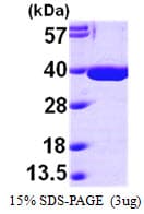 Human MDH / MDH2 Protein (Recombinant His)