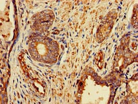 Polyclonal Rabbit anti-Human FZD1 / Frizzled 1 Antibody (IHC, IF)