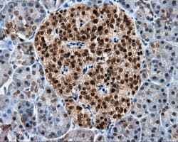 RIP1 / RALBP1 Antibody (clone OTI6E8)
