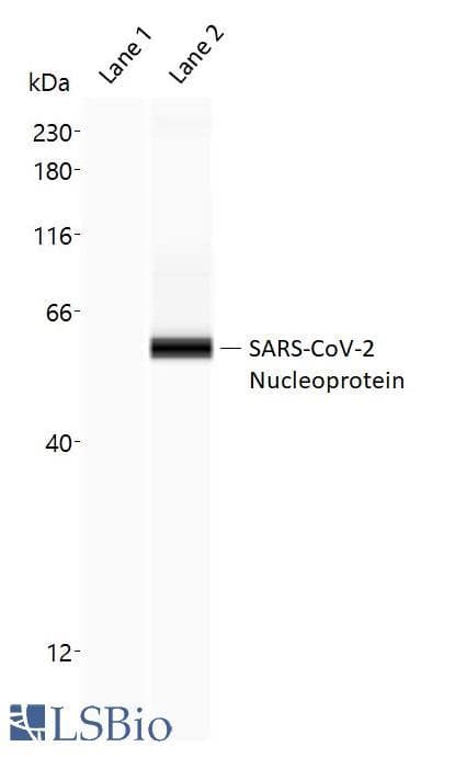 SARS-CoV-2 Nucleoprotein Antibody