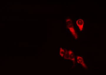 BAD Antibody