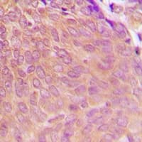 Polyclonal Rabbit anti-Human PP2Ac / PPP2CA Antibody (C-Terminus, IHC, IF, WB)