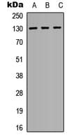 EPHA3 / EPH Receptor A3 Antibody (Internal)