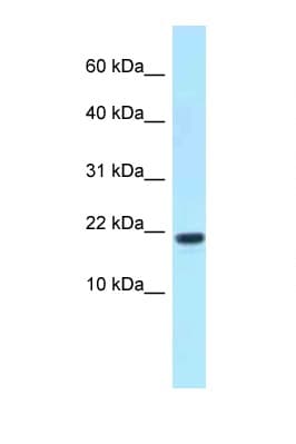 XAGE1E Antibody (C-Terminus)