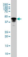 PathPlus™ FOXA1 Antibody (clone 2D7)