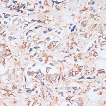 EIF4EBP1 / 4EBP1 Antibody
