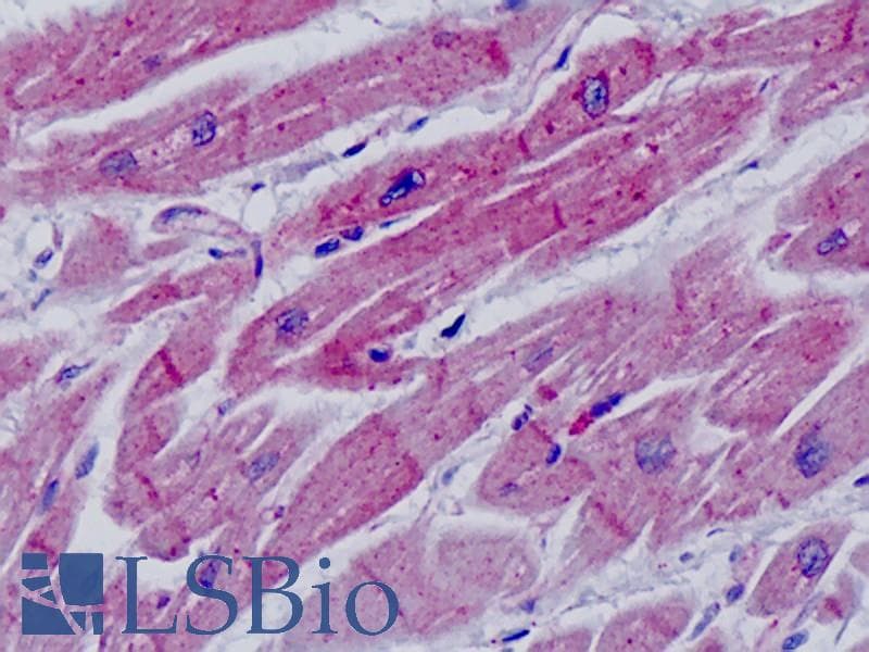 IHC-plus™ Polyclonal Rabbit anti-Human ADRA2C Antibody (aa336-385, IHC, WB)