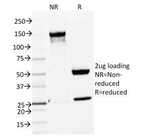 Monoclonal Mouse anti-Human ENAH / MENA Antibody (clone ENAH/1988, WB)