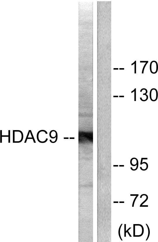 HDAC9 Antibody